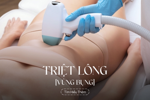 Triệt lông vùng bụng